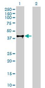 FAS Antibody in Western Blot (WB)