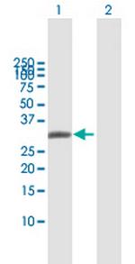 AQP7 Antibody in Western Blot (WB)