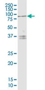 AR Antibody in Western Blot (WB)