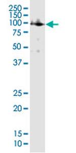 AR Antibody in Western Blot (WB)