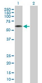 ARCN1 Antibody in Western Blot (WB)