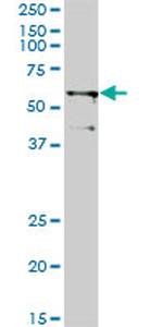 TRIM23 Antibody in Western Blot (WB)