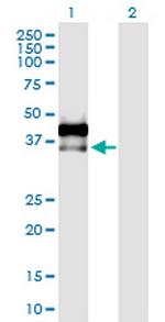 AREG Antibody in Western Blot (WB)