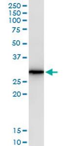 AREG Antibody in Western Blot (WB)