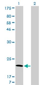 ARF5 Antibody in Western Blot (WB)