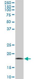 ARF5 Antibody in Western Blot (WB)