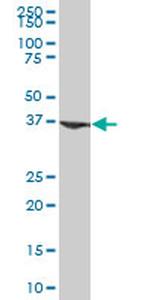 ARG1 Antibody in Western Blot (WB)