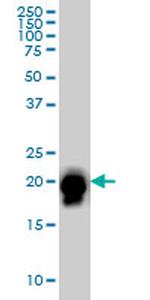 RHOA Antibody in Western Blot (WB)