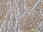 RHOA Antibody in Immunohistochemistry (Paraffin) (IHC (P))