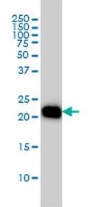 RHOA Antibody in Western Blot (WB)