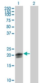 RHOA Antibody in Western Blot (WB)