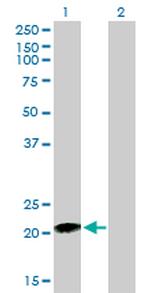 RHOC Antibody in Western Blot (WB)