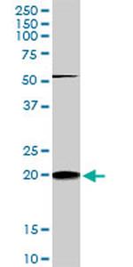 RHOC Antibody in Western Blot (WB)