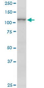 ARHGAP4 Antibody in Western Blot (WB)