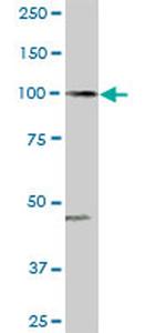 ARHGAP4 Antibody in Western Blot (WB)