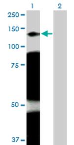 ARHGAP4 Antibody in Western Blot (WB)