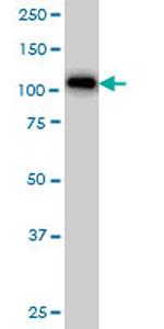 ARHGAP4 Antibody in Western Blot (WB)