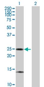 ARHGDIA Antibody in Western Blot (WB)