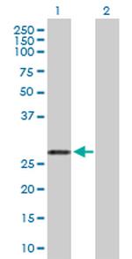 ARHGDIA Antibody in Western Blot (WB)