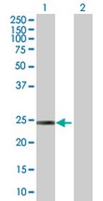 ARHGDIB Antibody in Western Blot (WB)