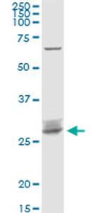 ARHGDIB Antibody in Western Blot (WB)