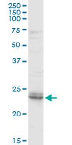 ARHGDIB Antibody in Western Blot (WB)