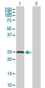 ARHGDIB Antibody in Western Blot (WB)