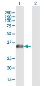 PHOX2A Antibody in Western Blot (WB)