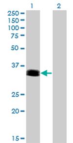 PHOX2A Antibody in Western Blot (WB)