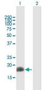 ARL2 Antibody in Western Blot (WB)