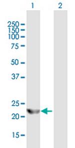 ARL3 Antibody in Western Blot (WB)