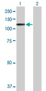 ARNT Antibody in Western Blot (WB)