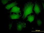 ARRB2 Antibody in Immunocytochemistry (ICC/IF)