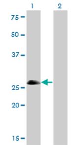 ASCL1 Antibody in Western Blot (WB)