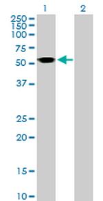 ASL Antibody in Western Blot (WB)