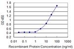 ASMT Antibody in ELISA (ELISA)