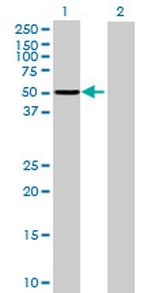 ASNS Antibody in Western Blot (WB)