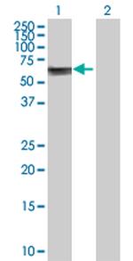 ASNS Antibody in Western Blot (WB)