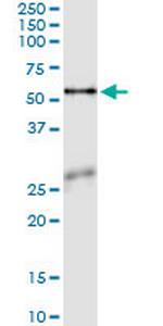 ASNS Antibody in Immunoprecipitation (IP)