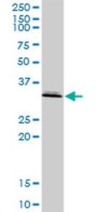 ASPA Antibody in Western Blot (WB)