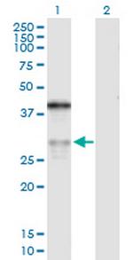 ASPH Antibody in Western Blot (WB)