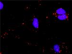 ATF4 Antibody in Proximity Ligation Assay (PLA) (PLA)