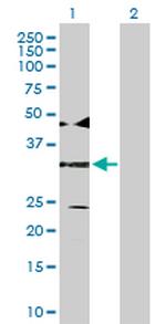 ATF4 Antibody in Western Blot (WB)