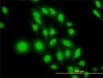 ATF4 Antibody in Immunocytochemistry (ICC/IF)