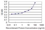 ATM Antibody in ELISA (ELISA)