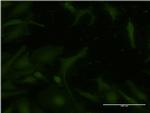 ATM Antibody in Immunocytochemistry (ICC/IF)