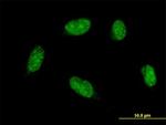 ATOH1 Antibody in Immunocytochemistry (ICC/IF)