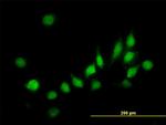 ATOX1 Antibody in Immunocytochemistry (ICC/IF)