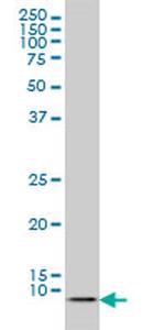 ATOX1 Antibody in Western Blot (WB)