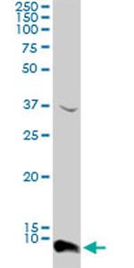 ATOX1 Antibody in Western Blot (WB)